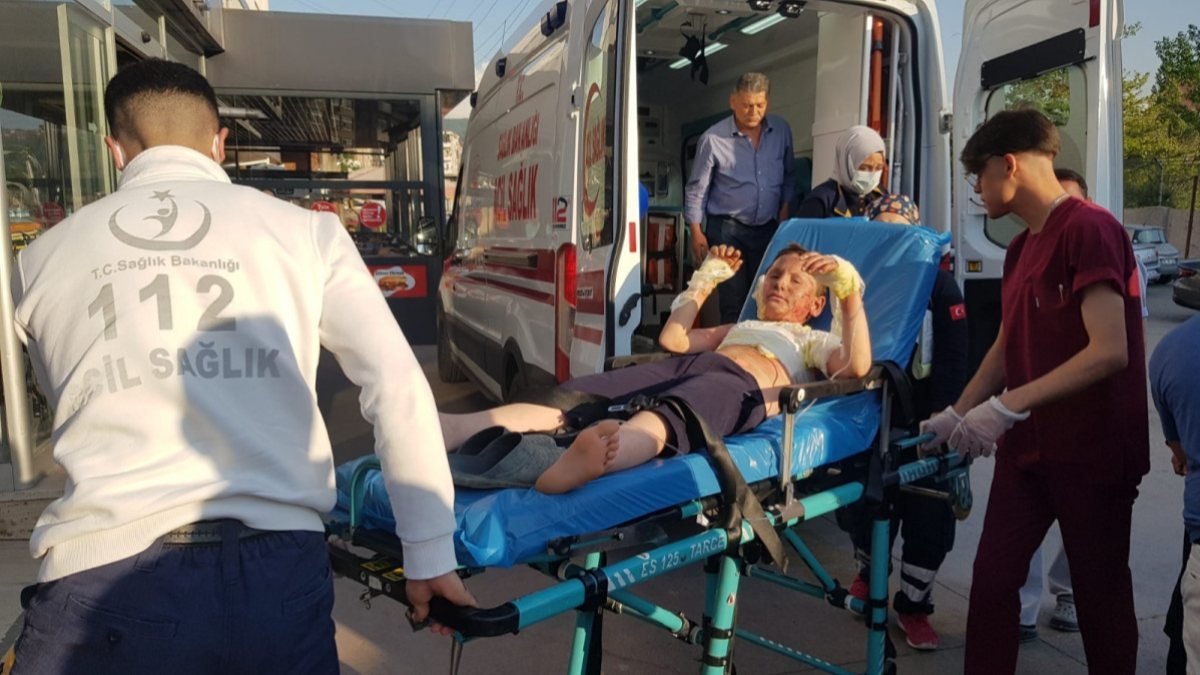 Zonguldak'ta benzin bidonunu yakan çocuk kendini de yaktı