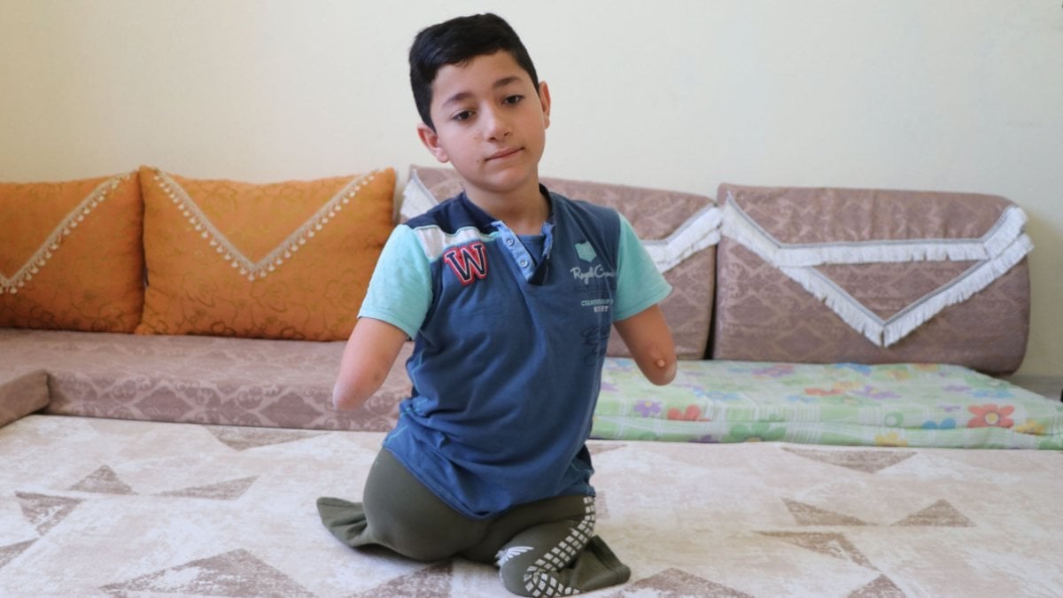 Van'da kolları ve bacakları olmayan çocuk, protez için destek bekliyor