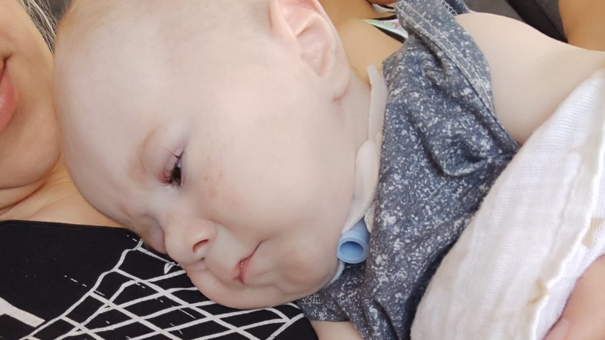 İzmit'te ölümcül hastalıkla doğan 7,5 aylık bebek için yardım çağrısı