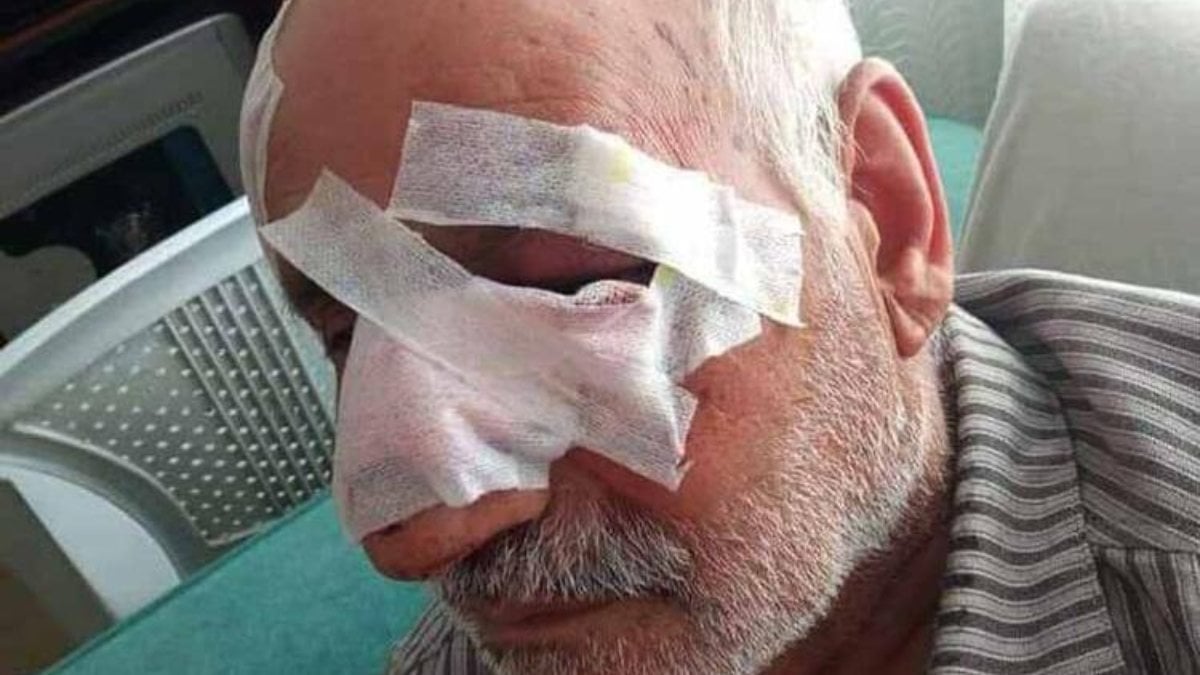 Gaziantep'te köpek saldırısına uğrayan yaşlı adam yoğun bakımda