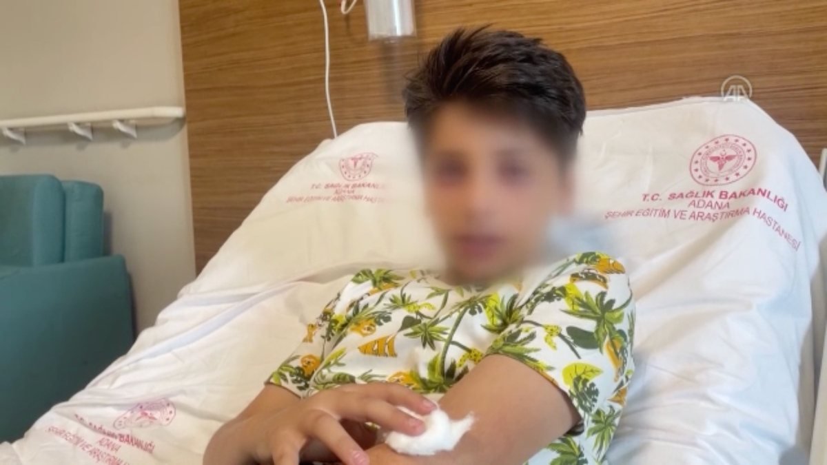 Adana'da video izleyip ses bombası yapan çocuk, gözünden yaralandı
