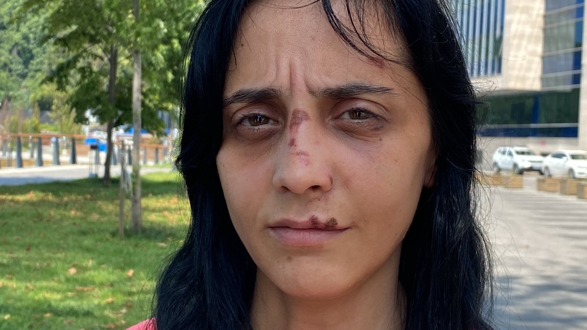 Zonguldak'ta bir kadın, tanımadığı şahsın saldırısına uğradı