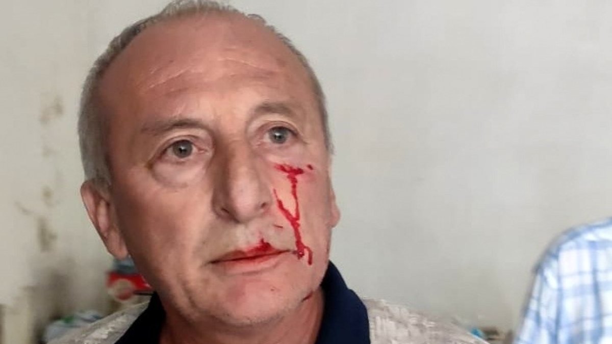 Yarbaşı Belediye Başkanı Mustafa Kaynar, dayısının saldırısına uğradı