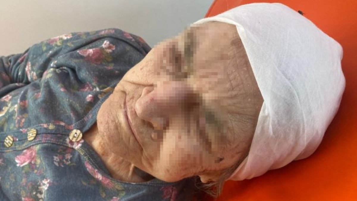 Bursa'da madde bağımlısı genç alzheimer hastası anneannesini darbetti