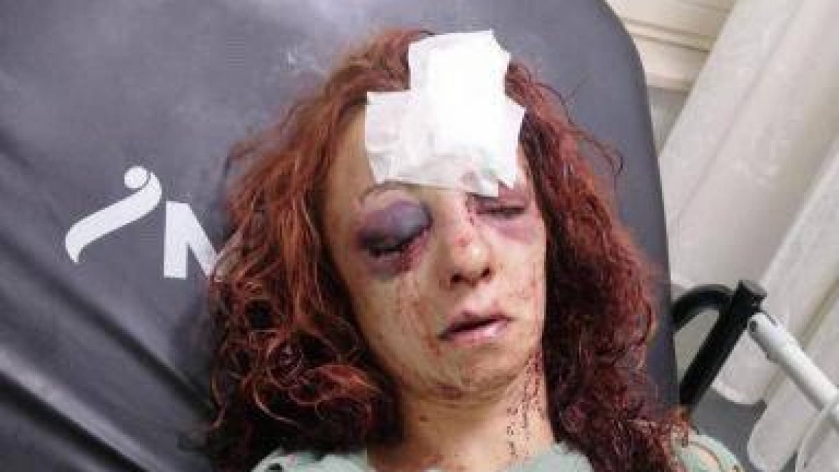 Mersin’de kıskançlık nedeniyle dövülen kadın yoğun bakımdan çıktı