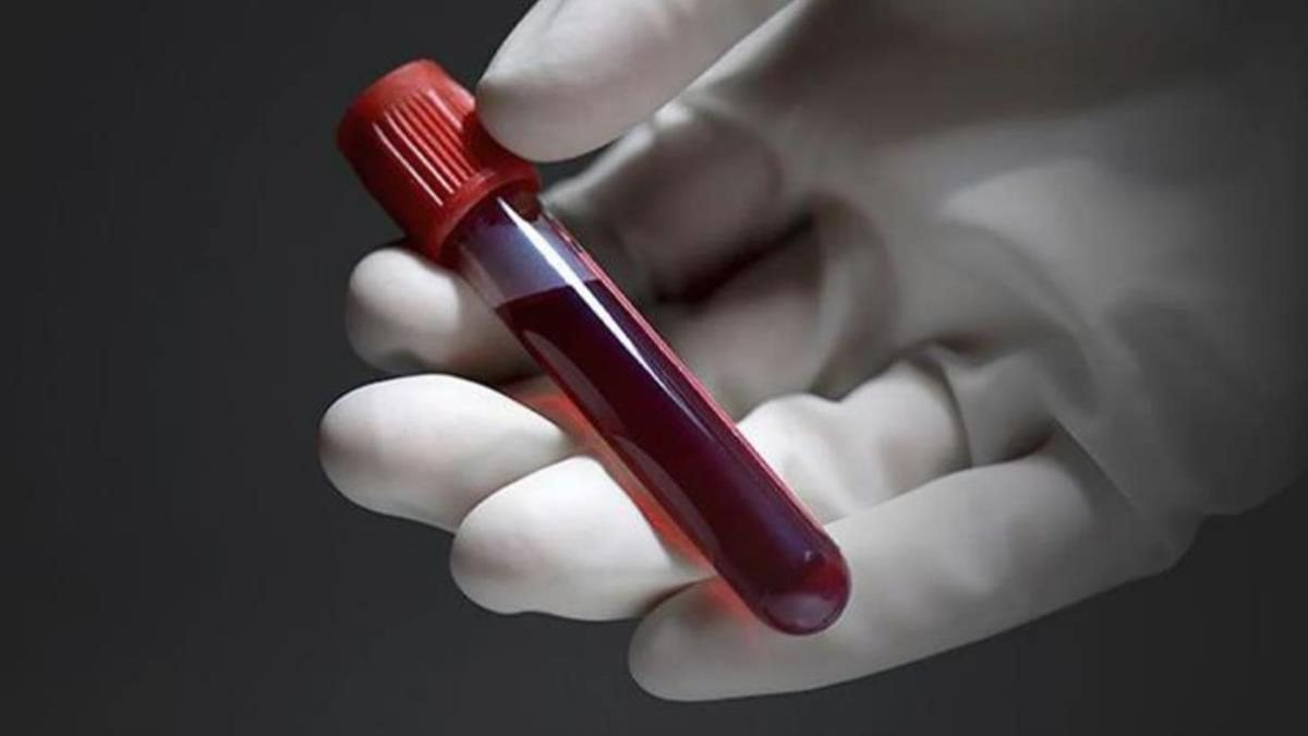 En tehlikeli kan grubu hangisidir? Bu kan grubundaki kişiler dikkat: Felç olma riski yüksek!