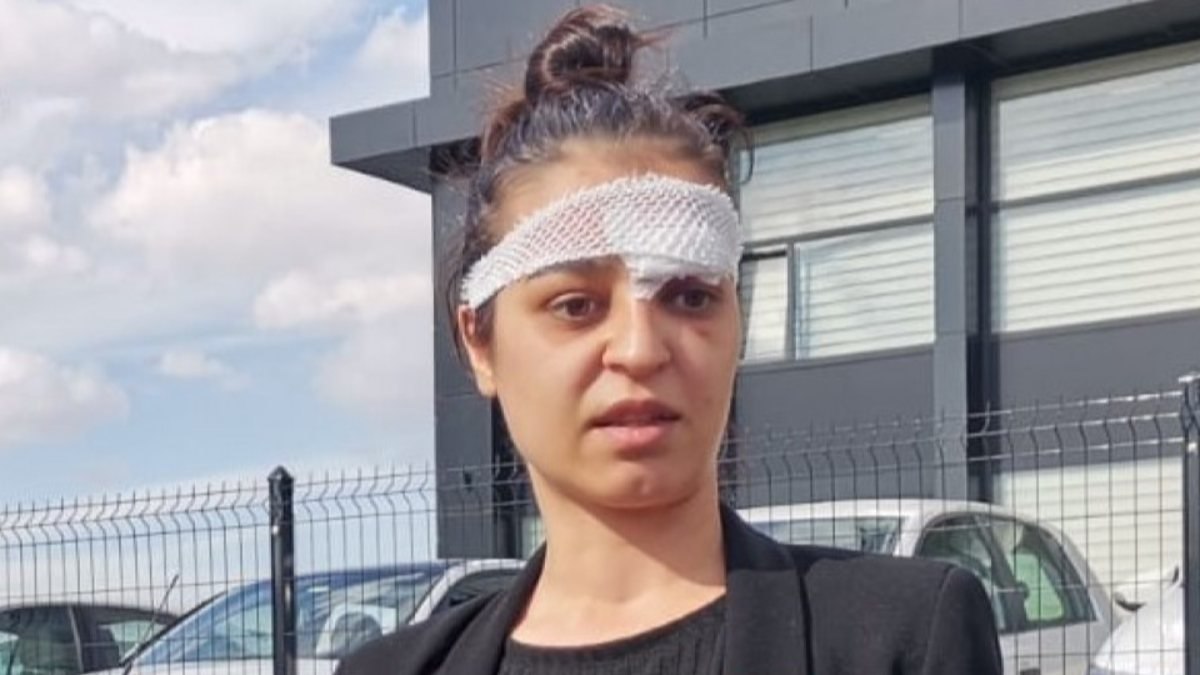 Ankara'da şiddet mağduru kadından eski kocaya suç duyurusu