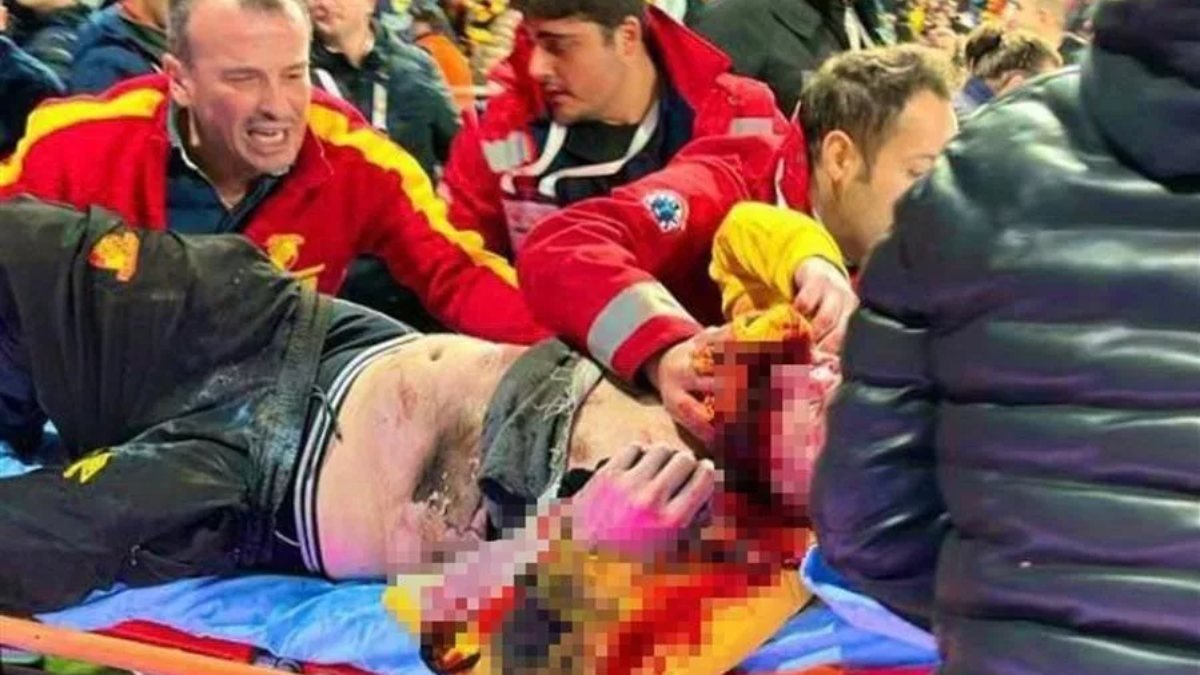 İzmir'de trübünde yaralanan taraftar yoğun bakımdan çıktı
