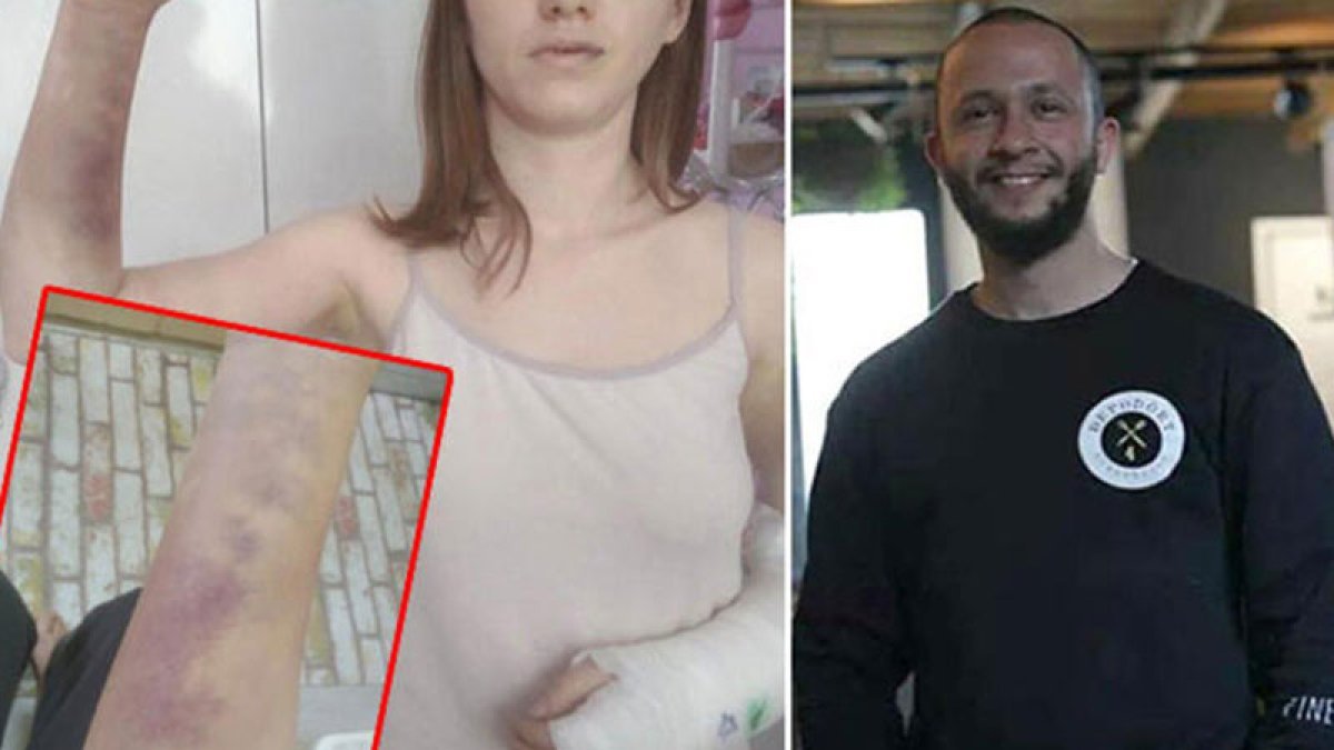 İzmir’de sevgilisini beyzbol sopasıyla döven sanığa 10 ay hapis