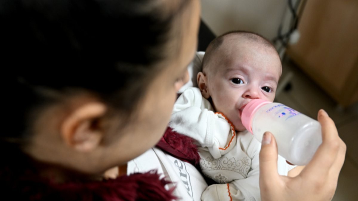 İzmir'de bağırsakları dışarıda doğan bebek, sağlığına kavuştu