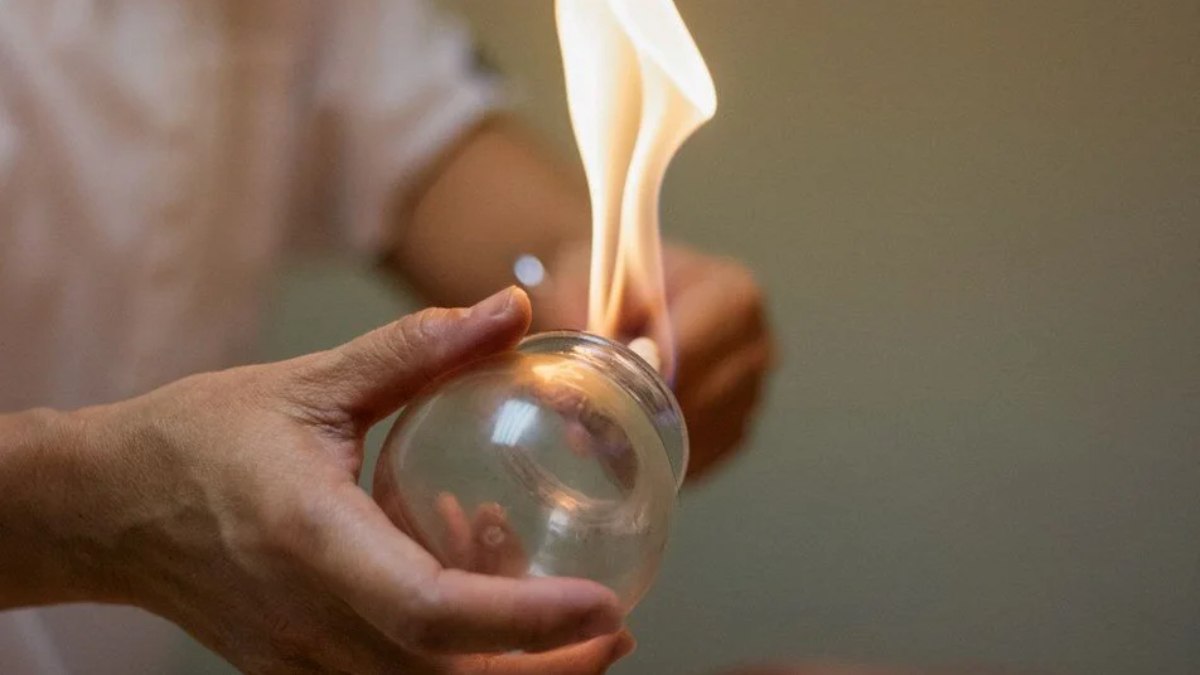 Hacamat yapılacak günler 2023: Şubat ayında ne zaman hacamat yapılır?