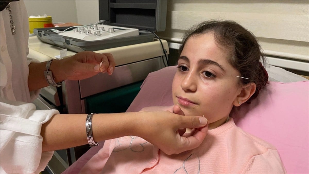 Samsun'da yüz felci geçiren 10 yaşındaki çocuk, akupunktur ile sağlığına kavuştu