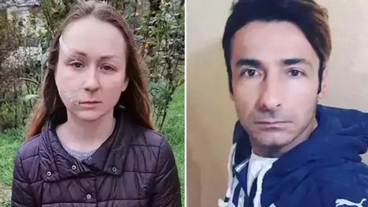 Boşanmak isteyen Ukraynalı eşinin yüzünü falçatayla kesti! Tahliye edildi