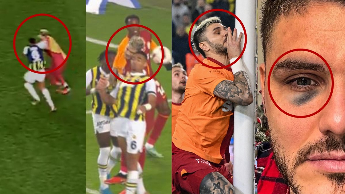 Sosyal medya bunu konuşuyor: Mauro Icardi'nin gözü ne zaman morardı