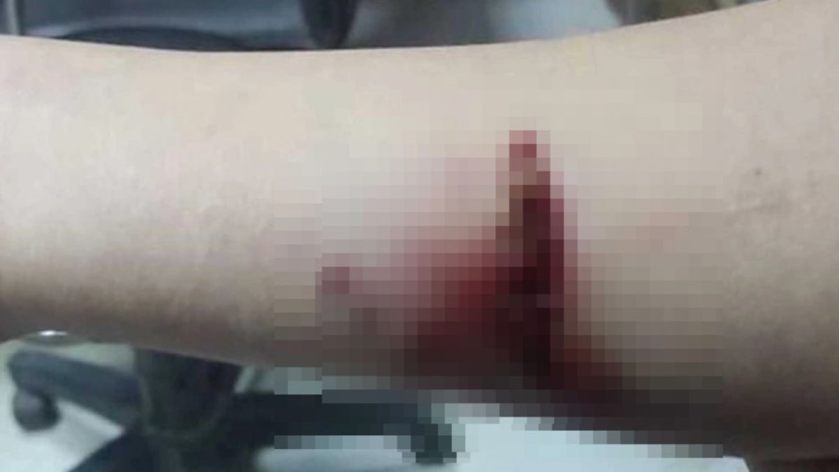 Diyarbak�r'da ba��bo� k�pek sald�r�s�... K���k �ocuk yaraland�