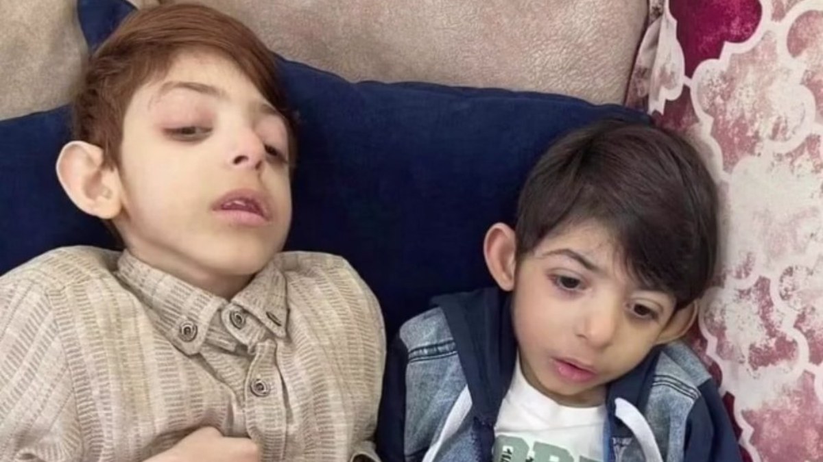 İsrail, Gazzelileri açlığa mahkum etti: İki kardeşten, birer saat arayla ölüm haberi geldi