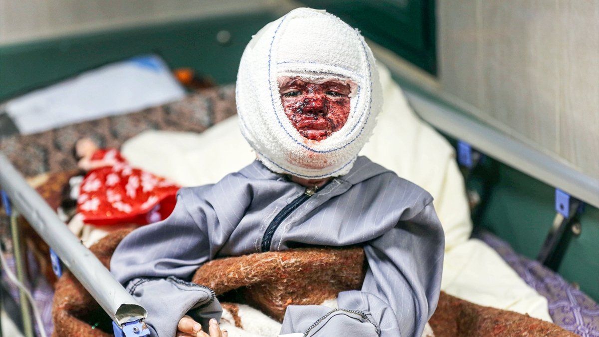 İsrail'in saldırılarında yaralanan 4 yaşındaki Seca'nın tedavisi hastane baskınında yarım kaldı