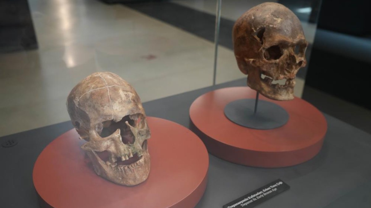 Birçok kişinin ölümüyle sonuçlandı! 5 bin yıllık ameliyat edilen kafatası Samsun'da sergileniyor