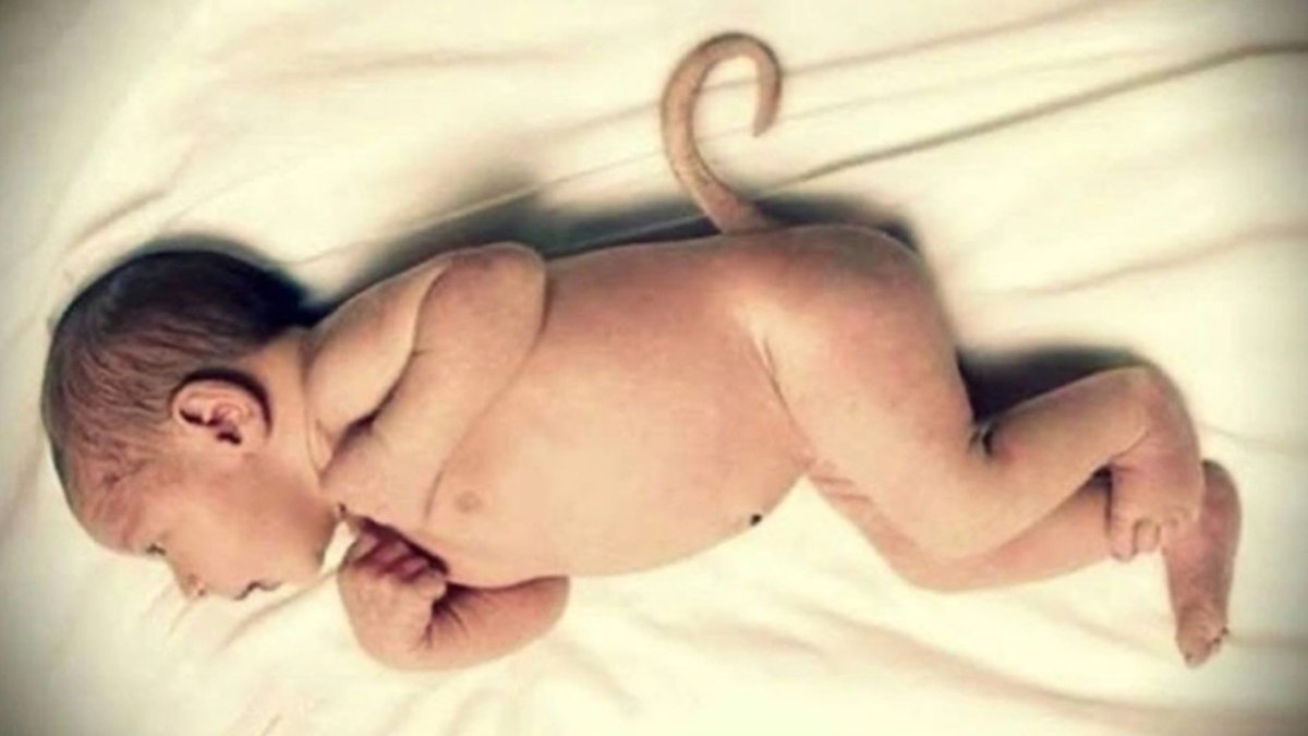 Böylesi görülmedi! Bebek kuyruklu doğdu, doktorlar şaştı kaldı...