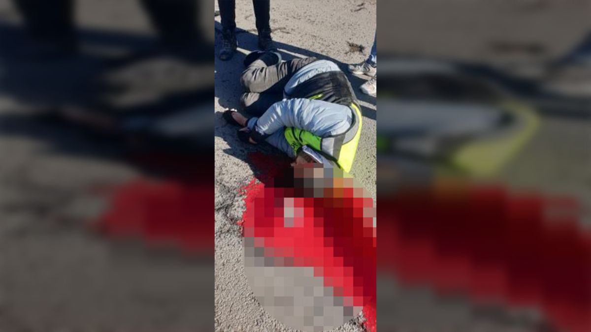 Ankara'da kamyonete çarpan ehliyetsiz motosikletli yaşam savaşı veriyor