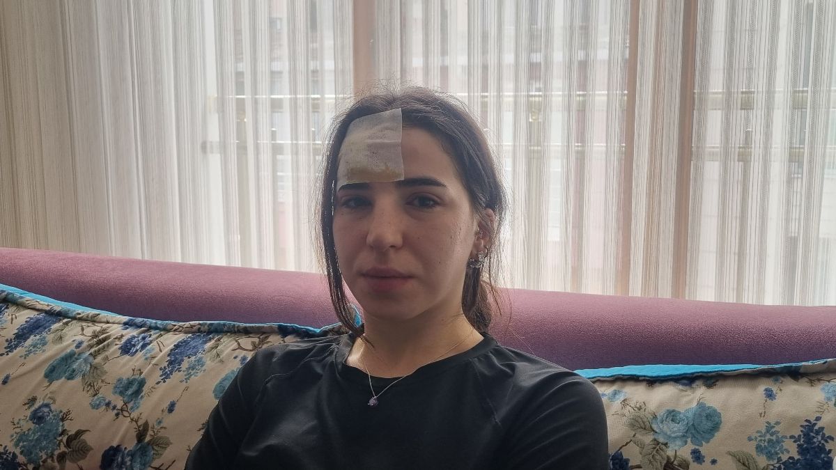 İstanbul'da başıboş köpek dehşeti: 3 tane zımba dikiş attılar