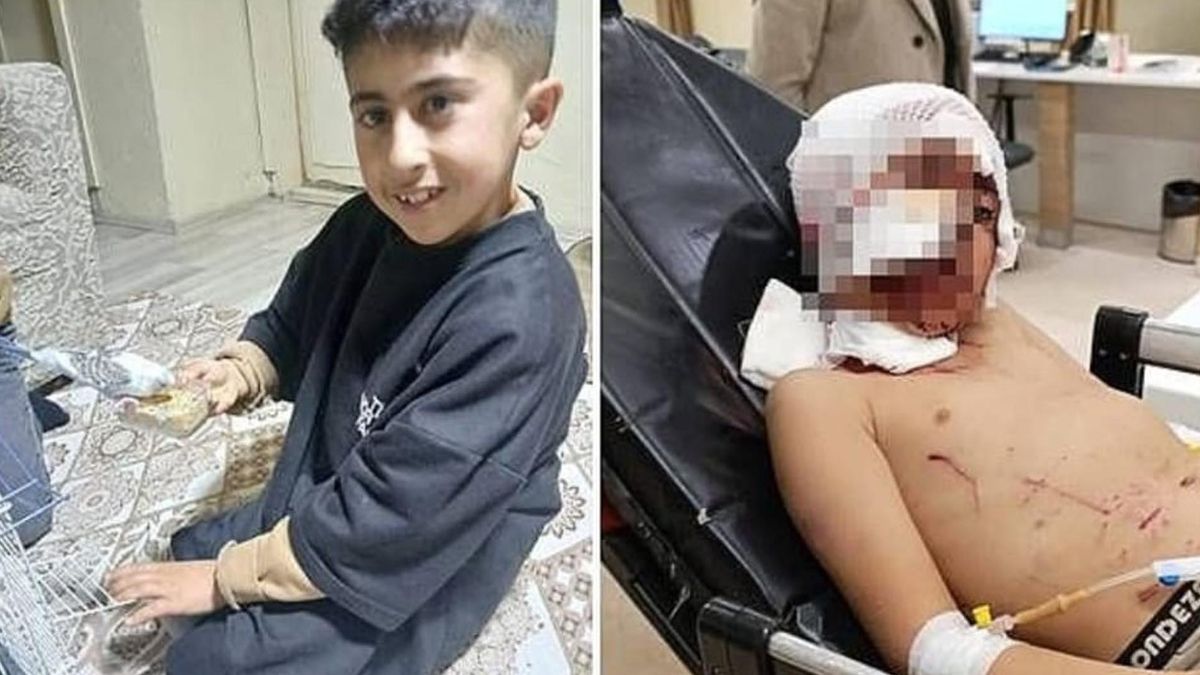 Erzurum’da 10 yaşındaki çocuğa başıboş köpek saldırdı