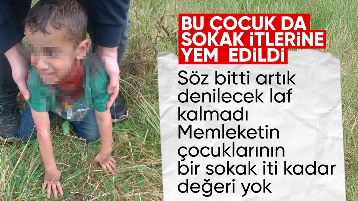 Yalova’da sokak köpeği saldırısı: 5 yaşındaki çocuğun durumu ağır