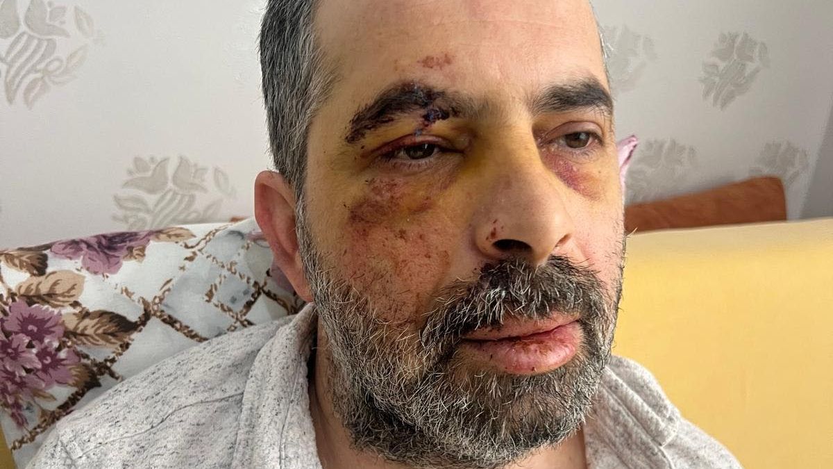 Konya’da köpeklerden kaçarken bisikletten düşüp, yaralandı Konya’da köpeklerden kaçarken bisikletten düşüp, yaralandı