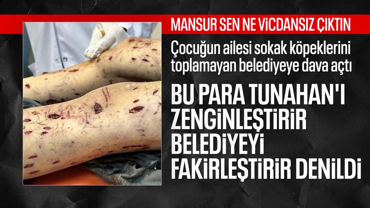Ankara’da köpeklerin saldırdığı Tunahan’ın ailesinden tazminat davası