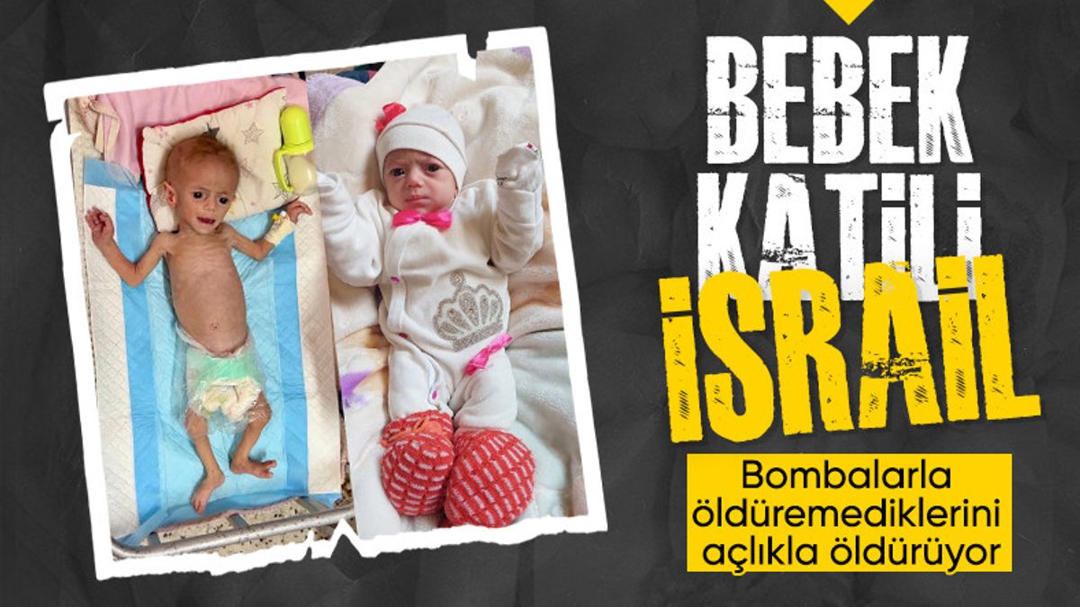 Gazze’de beş aylık Suvar Aşur, yetersiz beslenme yüzünden ölümle burun buruna