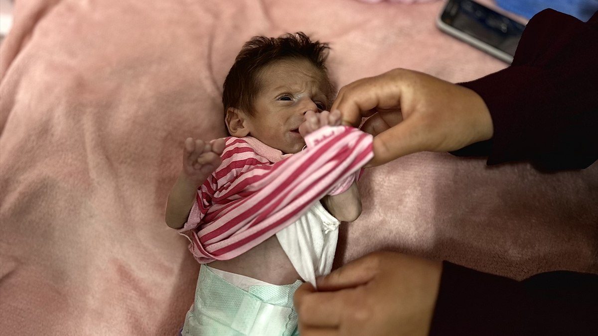 Gazze'de bir bebek daha açlık yüzünden can vermek üzere