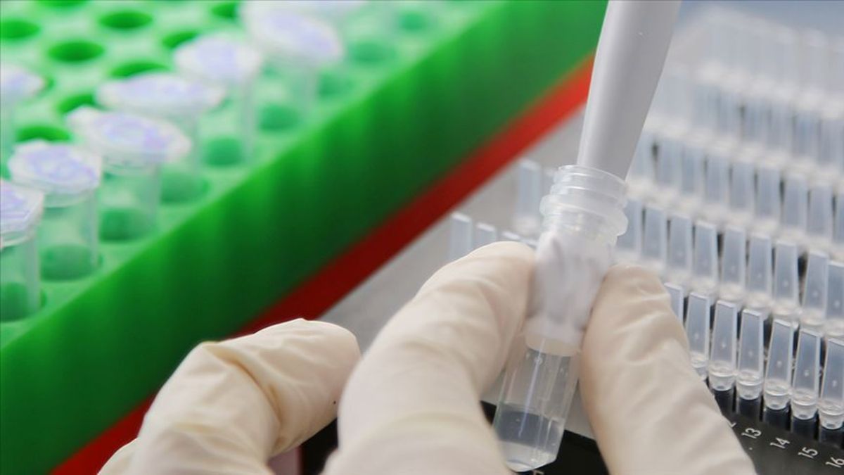 Fermuar aksamları ve kimyasallar için ithalat tarifesi belirlendi