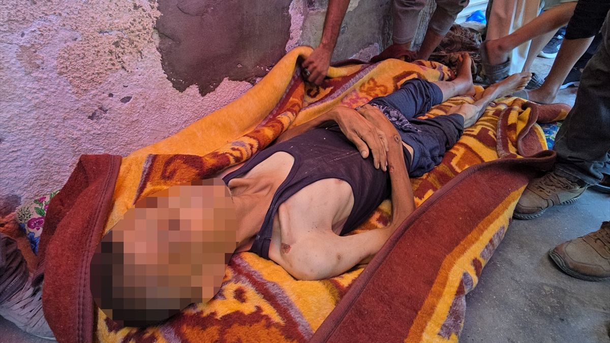 Gazze'de açlık ve yetersiz beslenme can almaya devam ediyor
