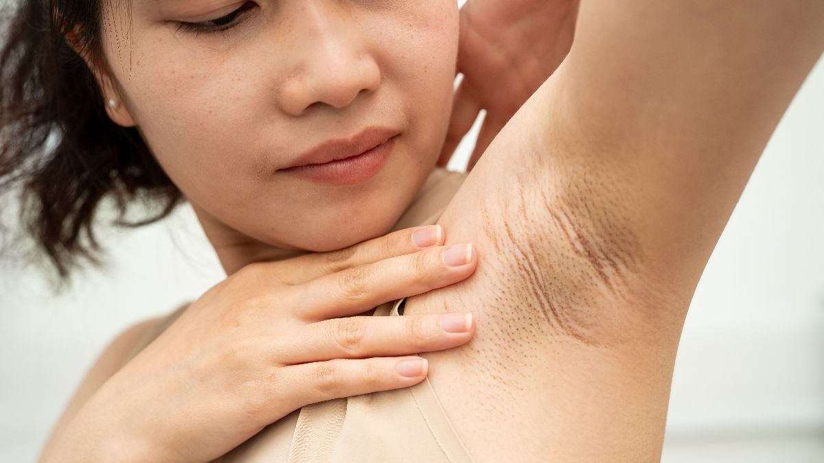 Beslenme alışkanlıkları ter kokusunu etkiliyor