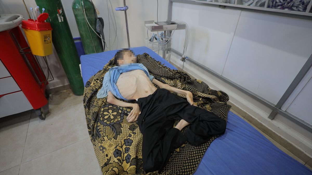 Gazze'de felaket devam ediyor: Felçli genç yetersiz beslenmeden yaşamını yitirdi