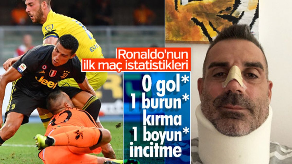 Chievo kalecisi Sorrentino'nun burnu kırıldı
