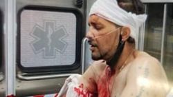 New York'ta bir adam kafasındaki bıçakla sokaklarda gezdi