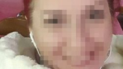 Eskişehir'de sevgilisine kezzap attı: 8 yıl 12 ay hapis