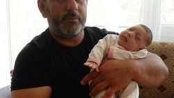 Konya'da kafasındaki kitleden kurtulan Hale bebek
