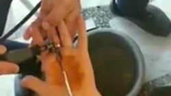 Denizli'de sıkışan yüzüğü itfaiye ekipleri çıkardı