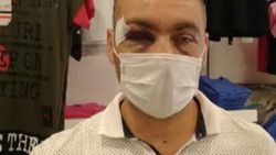 Kocaeli'de maske uyarısı yapan mağaza müdürüne saldırdı