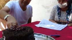 Aydın'da 41 yaşındaki Ferkan'ın zorlu yaşam mücadelesi