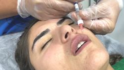 Hanife Gürdal, dudaklarını büyüttü