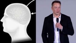 Elon Musk, 28 Ağustos'ta çalışan bir Neuralink cihazı gösterecek
