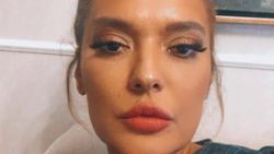 Demet Akalın, yeni dudaklarını çok beğendi