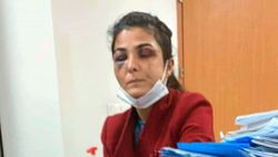 Antalya'da kendisine işkence yapan kocasını öldürdü