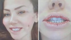 Lara, dudaklarını küçülttü