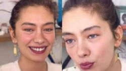 Neslihan Atagül, tedavi için İngiltere'ye gitti