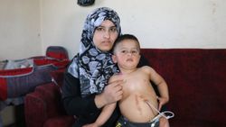 Adana'da yemek borusu olmayan Muhammed yardım bekliyor