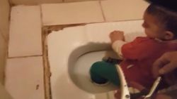Esenyurt’ta çocuğun ayağı tuvalet deliğine sıkıştı